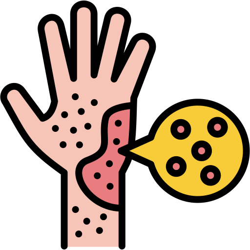 சொரியாசிஸ் தோல் நோய் சிகிச்சை (PSORIASIS)